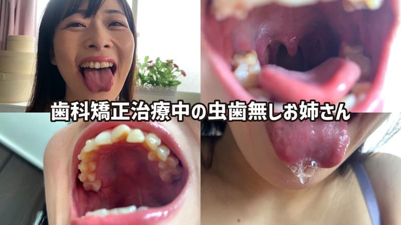街角で声をかけて口内観察させてもらう ファーストフード店パート みおりさん