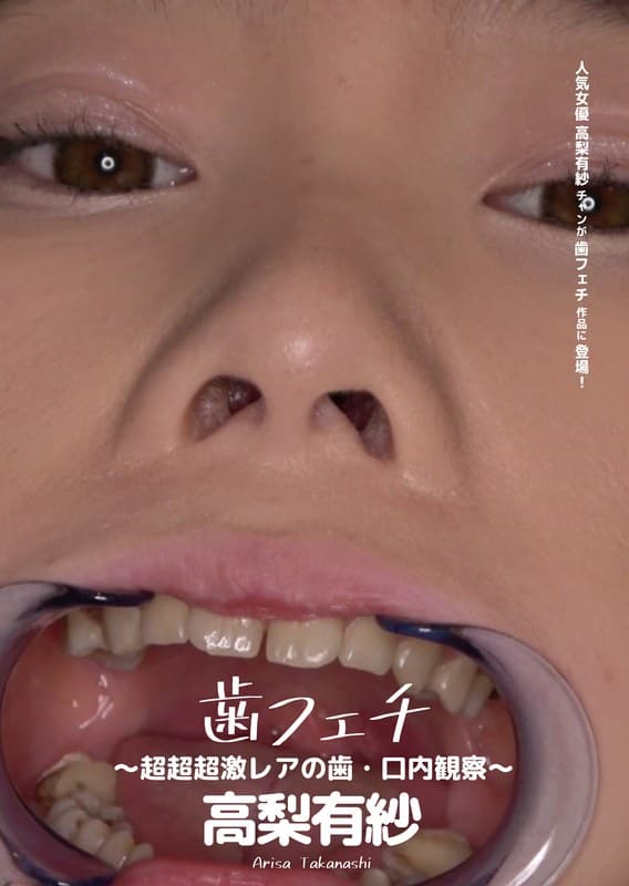歯フェチ ~超超超激レアの歯・口内観察~ 高梨有紗