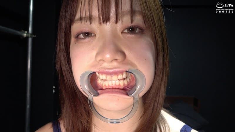 大人気女優 橋本りこチャンの歯・口内・舌ベロ観察プレイ!!!
